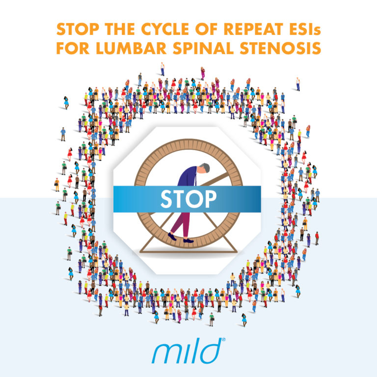 Stop the cycle of repeat ESIs for lumbar spinal stenosis.